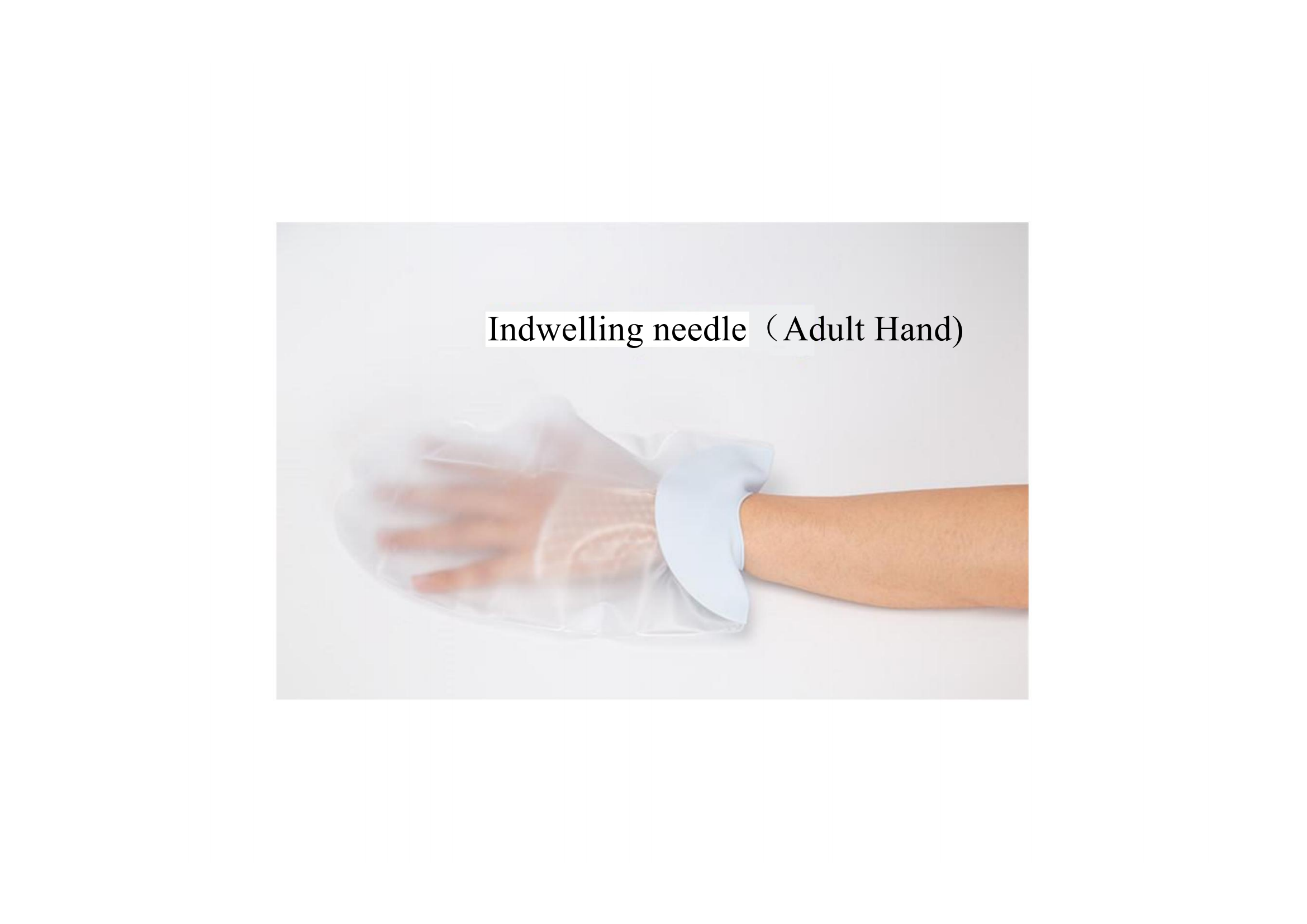 Indwelling needle(Adult Hand)